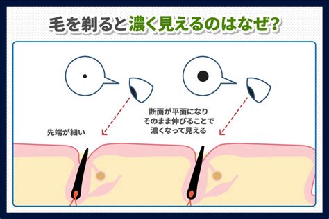 女 陰毛|陰毛処理は剃る？女性の生え方別の剃毛方法